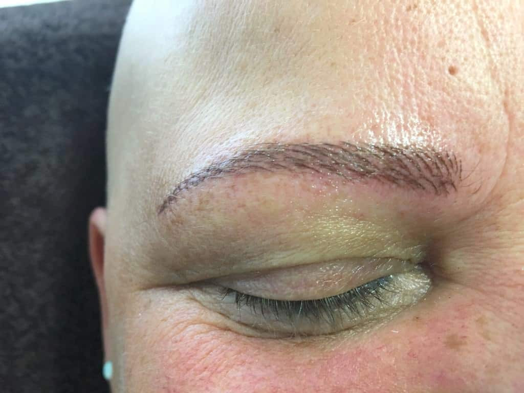 medizinisches-pigmentieren-nürtingen